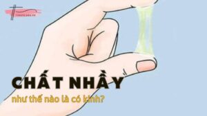Chất nhầy như thế nào là có kinh - Triệu chứng có kinh?