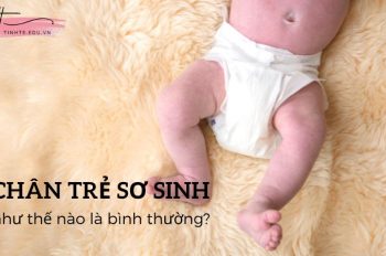 Chân trẻ sơ sinh như thế nào là bình thường? Khắc phục ra sao?