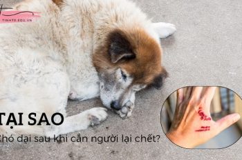 Bệnh dại là gì? Tại sao chó dại sau khi cắn người lại chết?