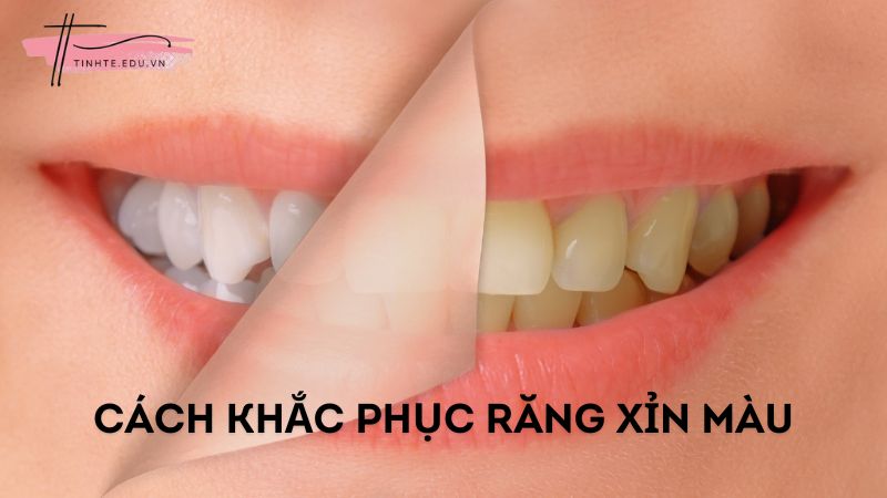 Bí quyết lấy lại nụ cười trắng sáng