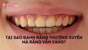 Tại sao đánh răng thường xuyên mà răng vẫn vàng ố, xỉn màu?