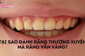Tại sao đánh răng thường xuyên mà răng vẫn vàng ố, xỉn màu?