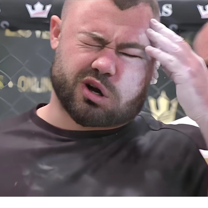 Meme tát vào đầu chất lừ
